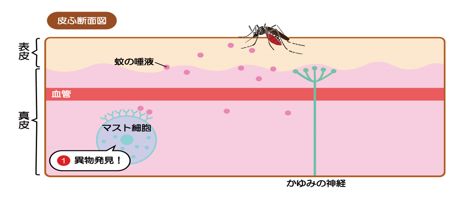 重要 アレルギー発症のメカニズムは起立性調節障害や発達障害など多くの病気でも働いています 神仙堂薬局